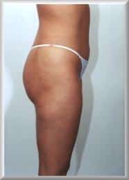After Image
