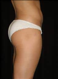 After Image