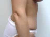 After Image
