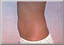 After Image