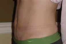 After Image
