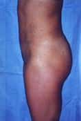 After Image
