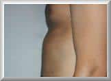 After Image