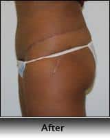 After Image
