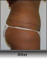 After Image