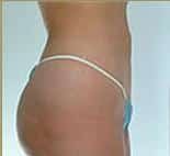 After Image