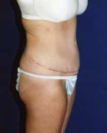 After Image