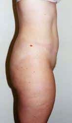 After Image