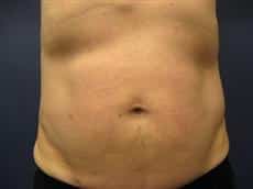 After Image