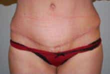 After Image