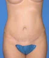After Image
