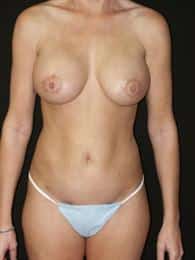 After Image