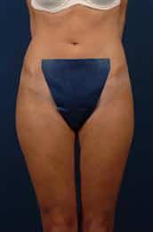 After Image
