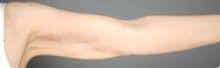 After Image