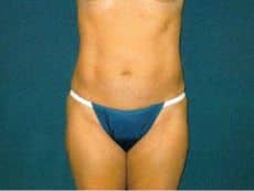 After Image