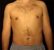 After Image