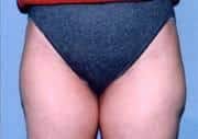 After Image