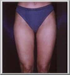After Image