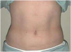 After Image