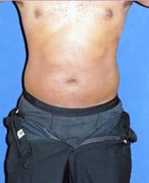 After Image