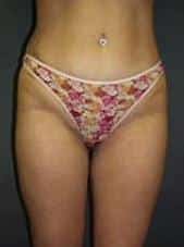 After Image