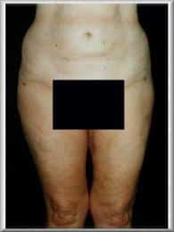 After Image