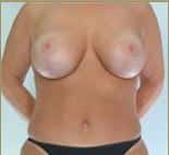 After Image