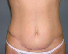 After Image