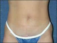 After Image