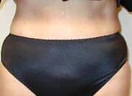After Image