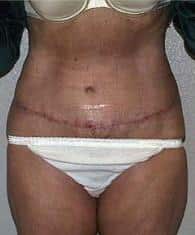 After Image