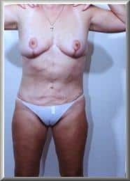 After Image