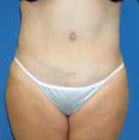 After Image