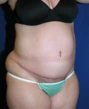 After Image