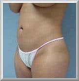 After Image