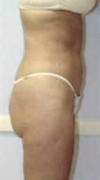 After Image