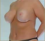 After Image
