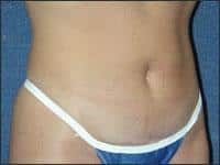 After Image