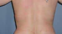 After Image