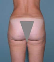 After Image