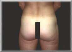 After Image