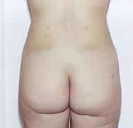 After Image