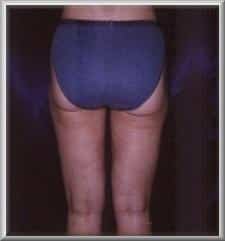 After Image
