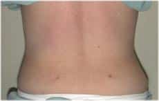 After Image