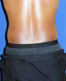 After Image