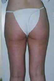After Image