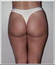 After Image