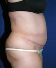 After Image