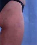 After Image