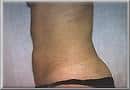 After Image